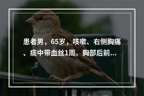 患者男，65岁，咳嗽、右侧胸痛、痰中带血丝1周。胸部后前位片