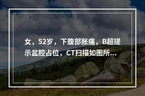 女，52岁，下腹部胀痛，B超提示盆腔占位，CT扫描如图所示，