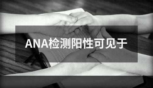 ANA检测阳性可见于