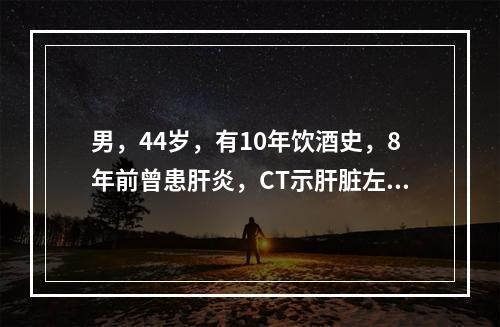 男，44岁，有10年饮酒史，8年前曾患肝炎，CT示肝脏左叶和