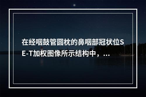 在经咽鼓管圆枕的鼻咽部冠状位SE-T加权图像所示结构中，以下