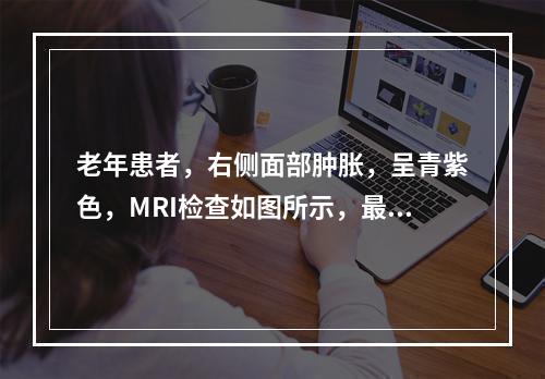 老年患者，右侧面部肿胀，呈青紫色，MRI检查如图所示，最可能