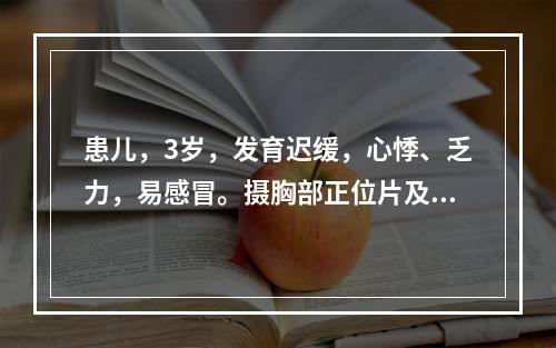 患儿，3岁，发育迟缓，心悸、乏力，易感冒。摄胸部正位片及造影