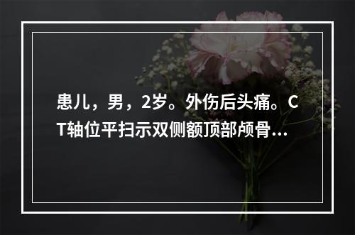 患儿，男，2岁。外伤后头痛。CT轴位平扫示双侧额顶部颅骨内板