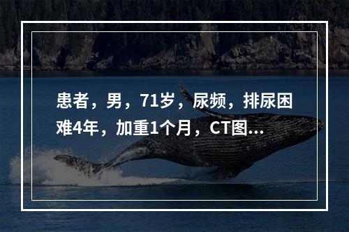 患者，男，71岁，尿频，排尿困难4年，加重1个月，CT图像见