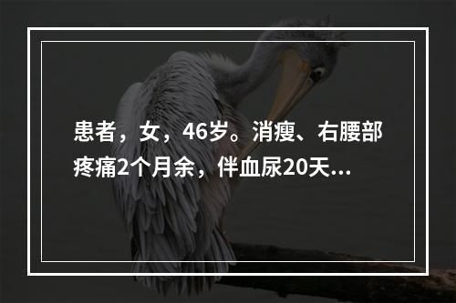 患者，女，46岁。消瘦、右腰部疼痛2个月余，伴血尿20天，C