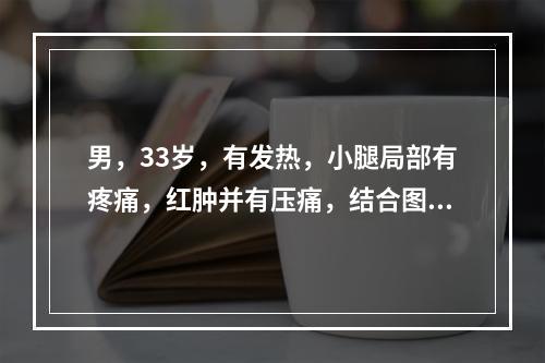 男，33岁，有发热，小腿局部有疼痛，红肿并有压痛，结合图像，