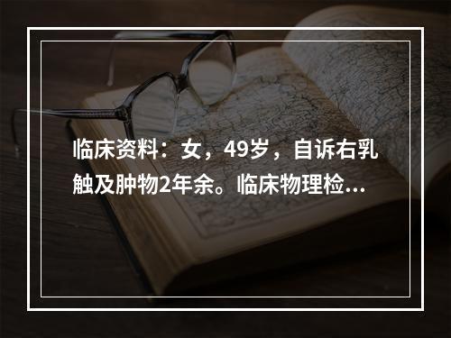 临床资料：女，49岁，自诉右乳触及肿物2年余。临床物理检查：