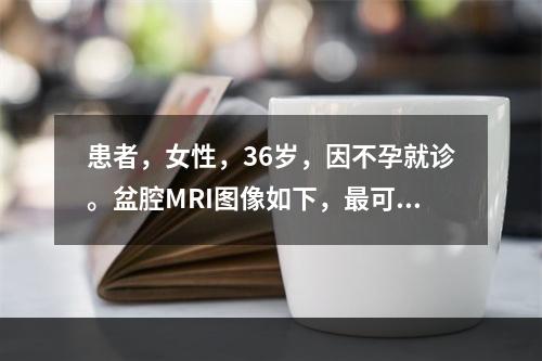 患者，女性，36岁，因不孕就诊。盆腔MRI图像如下，最可能的