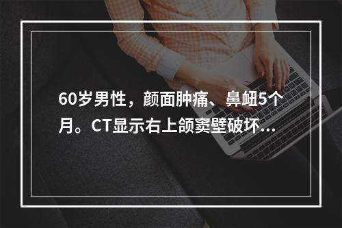 60岁男性，颜面肿痛、鼻衄5个月。CT显示右上颌窦壁破坏，内