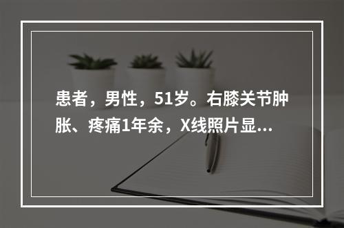 患者，男性，51岁。右膝关节肿胀、疼痛1年余，X线照片显示：