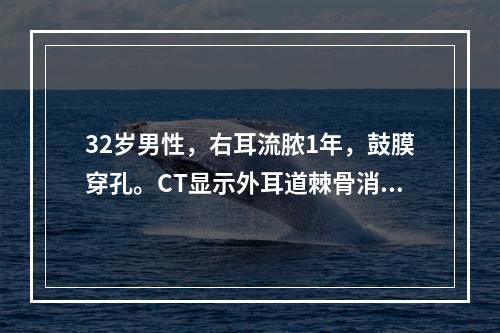 32岁男性，右耳流脓1年，鼓膜穿孔。CT显示外耳道棘骨消失，