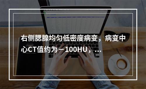 右侧腮腺均匀低密度病变，病变中心CT值约为－100HU，最可