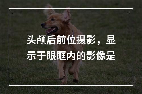 头颅后前位摄影，显示于眼眶内的影像是