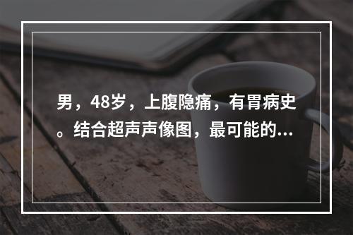 男，48岁，上腹隐痛，有胃病史。结合超声声像图，最可能的诊断