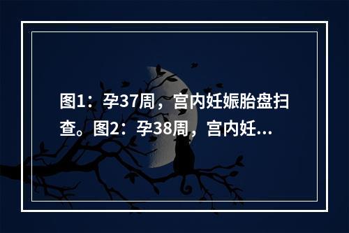 图1：孕37周，宫内妊娠胎盘扫查。图2：孕38周，宫内妊娠胎