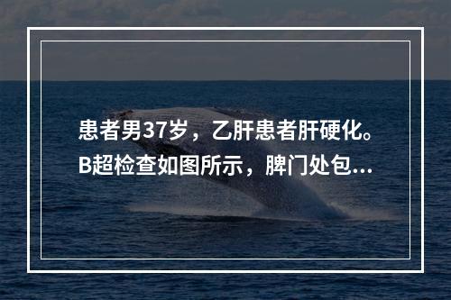 患者男37岁，乙肝患者肝硬化。B超检查如图所示，脾门处包块，