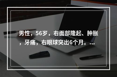 男性，56岁，右面部隆起、肿胀，牙痛，右眼球突出6个月。CT