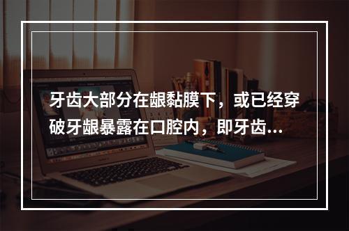 牙齿大部分在龈黏膜下，或已经穿破牙龈暴露在口腔内，即牙齿开始