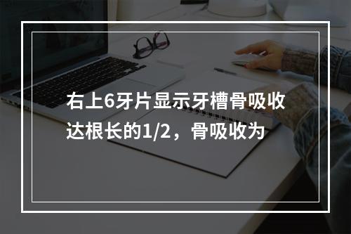 右上6牙片显示牙槽骨吸收达根长的1/2，骨吸收为