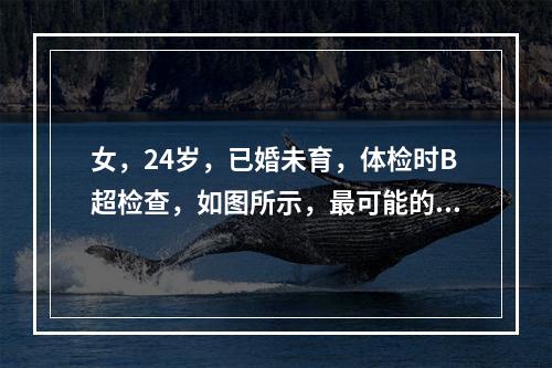 女，24岁，已婚未育，体检时B超检查，如图所示，最可能的诊断