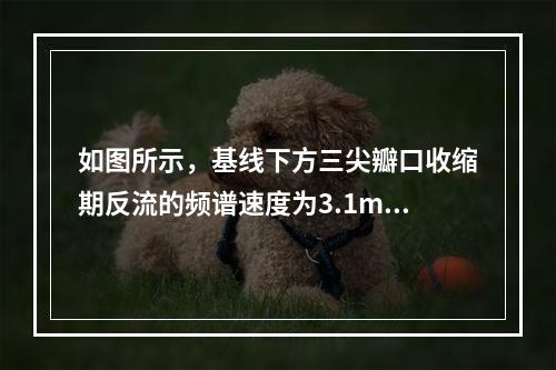 如图所示，基线下方三尖瓣口收缩期反流的频谱速度为3.1m/s