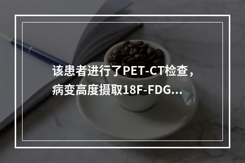 该患者进行了PET-CT检查，病变高度摄取18F-FDG。最