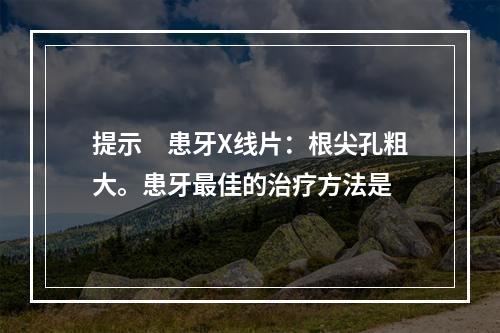 提示　患牙X线片：根尖孔粗大。患牙最佳的治疗方法是