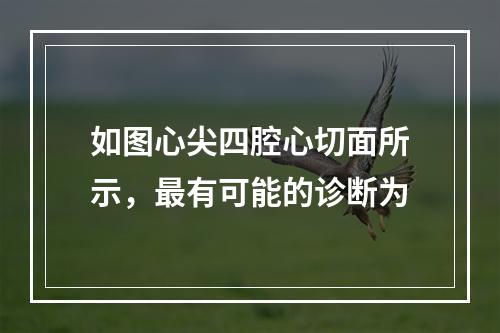 如图心尖四腔心切面所示，最有可能的诊断为