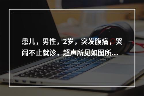 患儿，男性，2岁，突发腹痛，哭闹不止就诊，超声所见如图所示，