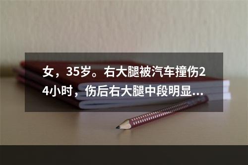 女，35岁。右大腿被汽车撞伤24小时，伤后右大腿中段明显肿胀