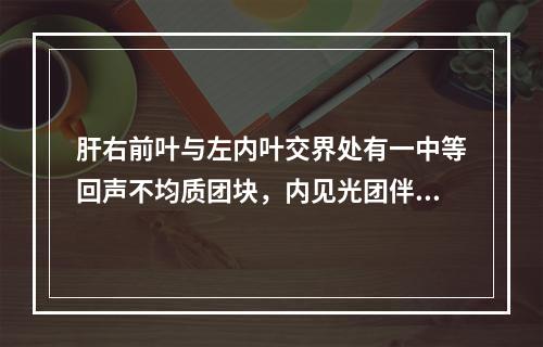 肝右前叶与左内叶交界处有一中等回声不均质团块，内见光团伴声影