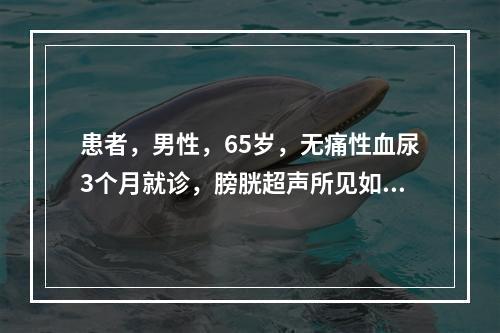 患者，男性，65岁，无痛性血尿3个月就诊，膀胱超声所见如图，