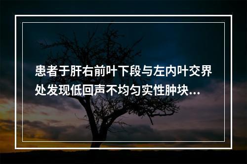 患者于肝右前叶下段与左内叶交界处发现低回声不均匀实性肿块，边