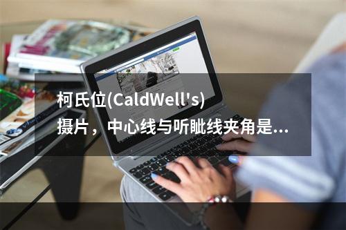 柯氏位(CaldWell's)摄片，中心线与听眦线夹角是()