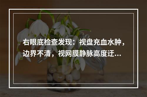 右眼底检查发现：视盘充血水肿，边界不清，视网膜静脉高度迂曲扩