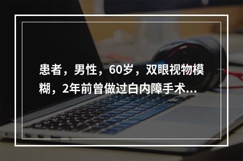 患者，男性，60岁，双眼视物模糊，2年前曾做过白内障手术，既