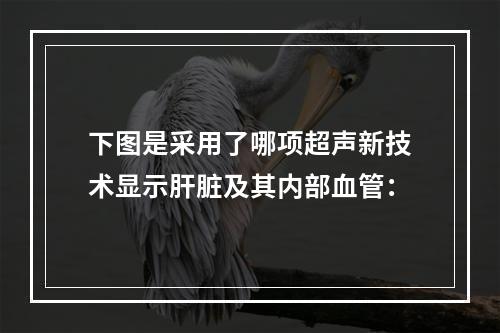 下图是采用了哪项超声新技术显示肝脏及其内部血管：