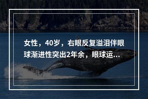 女性，40岁，右眼反复溢泪伴眼球渐进性突出2年余，眼球运动受