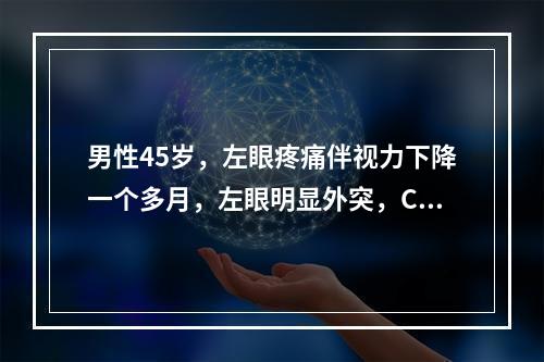 男性45岁，左眼疼痛伴视力下降一个多月，左眼明显外突，CT扫