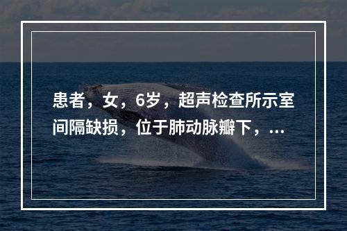 患者，女，6岁，超声检查所示室间隔缺损，位于肺动脉瓣下，应称