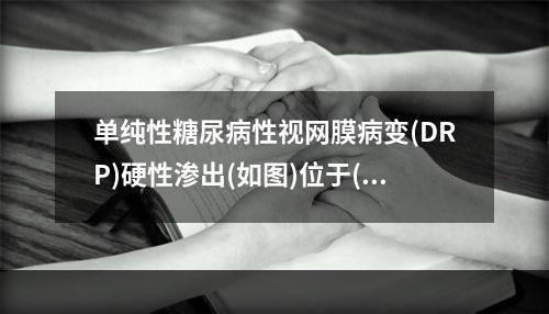 单纯性糖尿病性视网膜病变(DRP)硬性渗出(如图)位于()