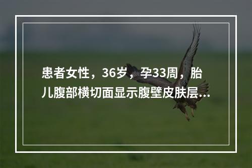 患者女性，36岁，孕33周，胎儿腹部横切面显示腹壁皮肤层回声