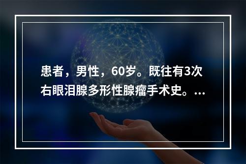 患者，男性，60岁。既往有3次右眼泪腺多形性腺瘤手术史。近1