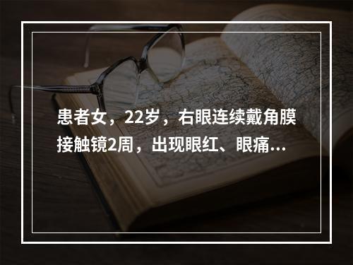 患者女，22岁，右眼连续戴角膜接触镜2周，出现眼红、眼痛、视