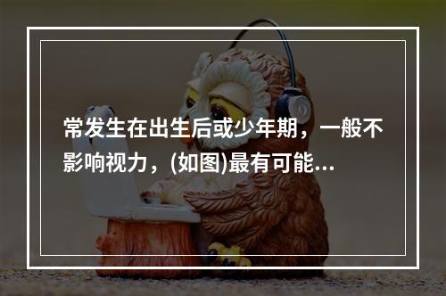 常发生在出生后或少年期，一般不影响视力，(如图)最有可能是何