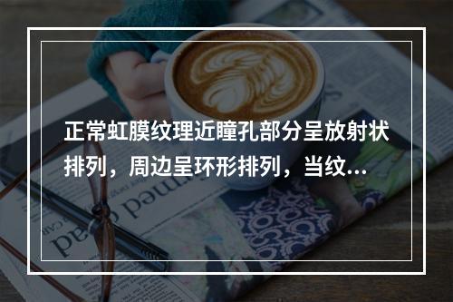 正常虹膜纹理近瞳孔部分呈放射状排列，周边呈环形排列，当纹理模