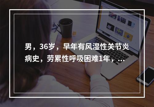 男，36岁，早年有风湿性关节炎病史，劳累性呼吸困难1年，近两