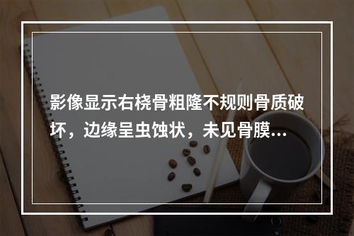 影像显示右桡骨粗隆不规则骨质破坏，边缘呈虫蚀状，未见骨膜反应