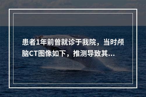 患者1年前曾就诊于我院，当时颅脑CT图像如下，推测导致其当日